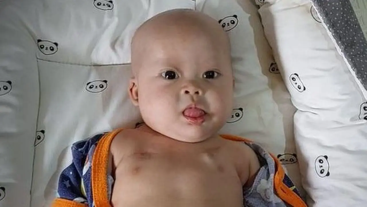 Kisah Chiara: Bayi 8 Bulan Berjuang Melawan Tumor Ganas, Jantung Bocor, dan Down Syndrome Kisah Chiara: Bayi 8 Bulan Berjuang Melawan Tumor Ganas, Jantung Bocor, dan Down Syndrome