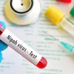 Kemenkes Tegaskan Belum Ada Kasus Virus Nipah di Indonesia, Pengawasan Ditingkatkan