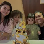 Cesen Eks JKT48 Jalani Operasi Tulang Ekor Setelah 8 Tahun Menahan Sakit